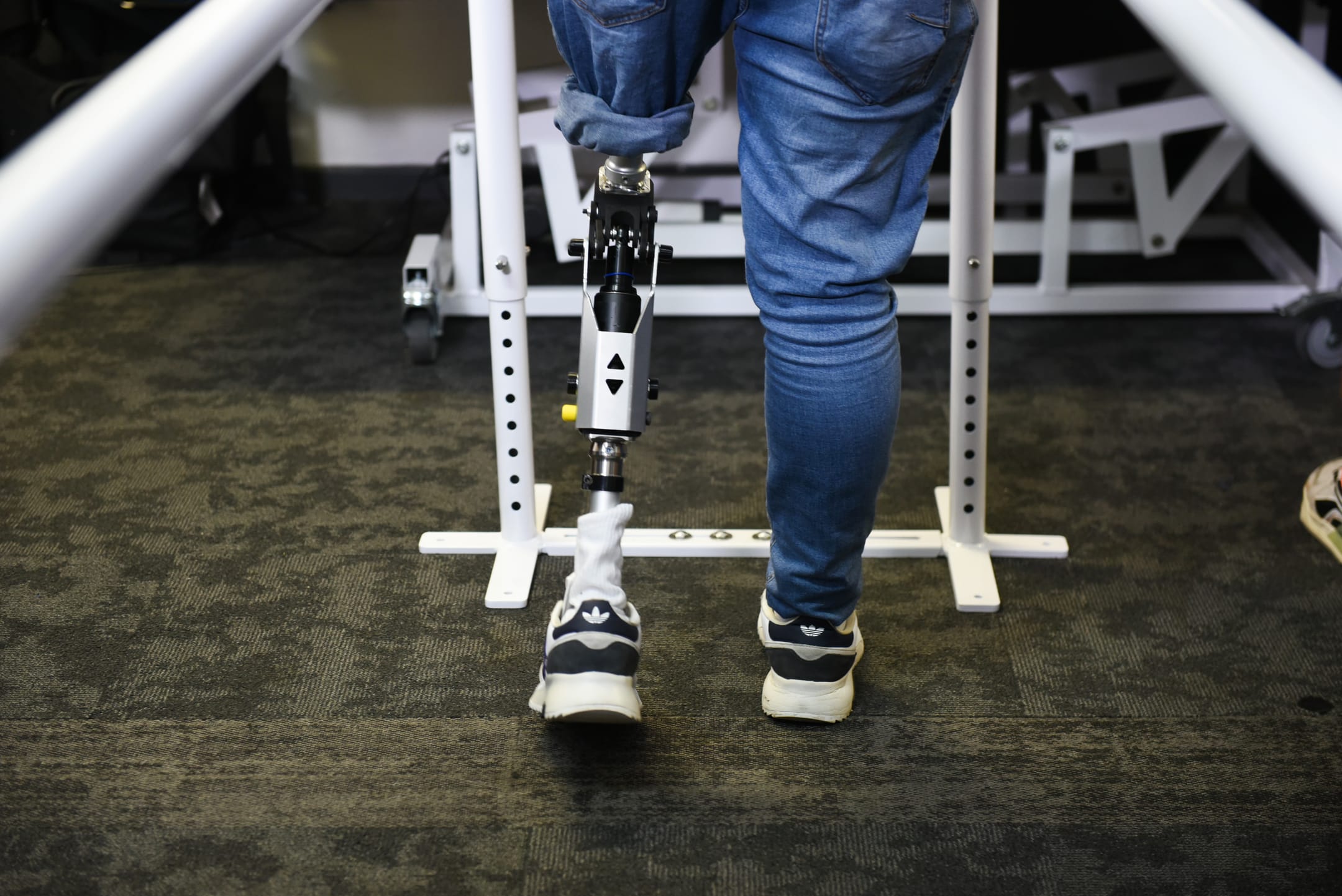 A patient walking on an NK Gen 1 knee between parallel bars